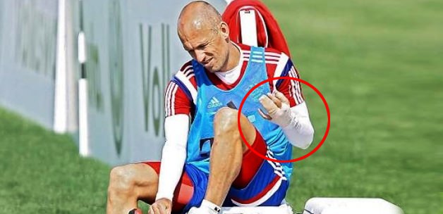 Yok artık! Robben'e timsah saldırdı